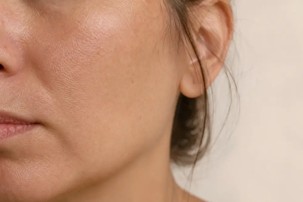 Joue et pommette d’une femme adulte en gros plan, sans maquillage, quelques taches pigmentaires visibles